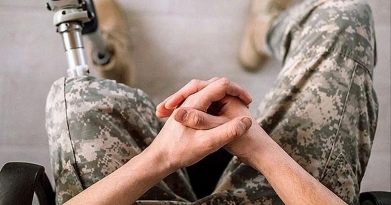 Протезний мінігейт (Антоніна Кумка)